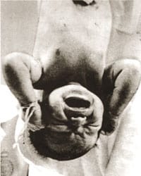 baby_birth